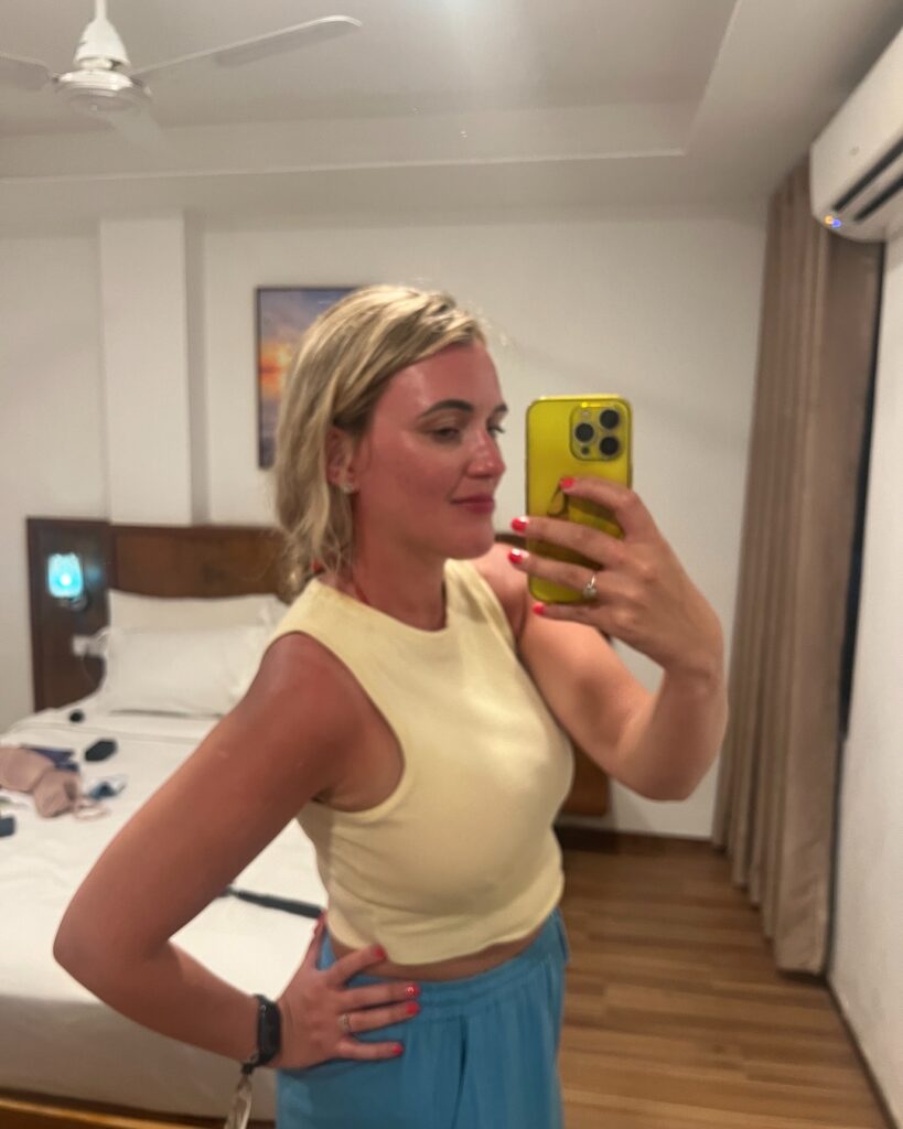sunburnt
